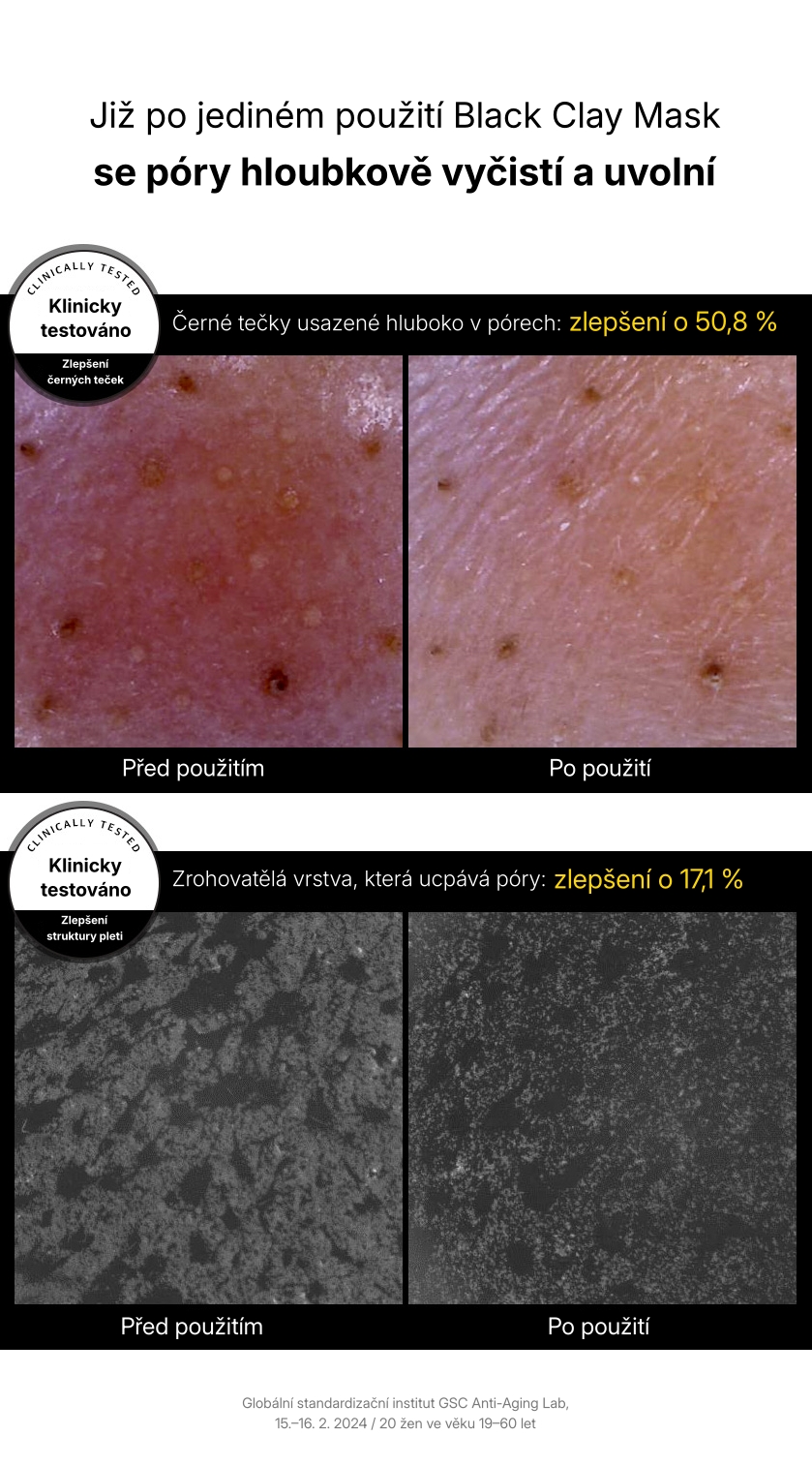 1.4. BARULAB Detailed Page 7in1 Total Solution Black Clay Mask